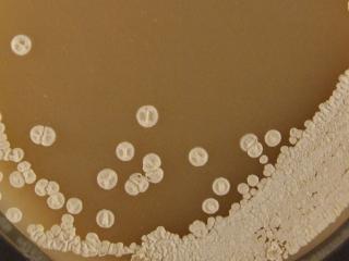 Streptomyces albus close-up (Clare Willis)